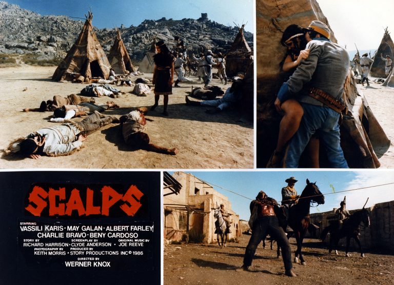 Scalps © MultiVideo